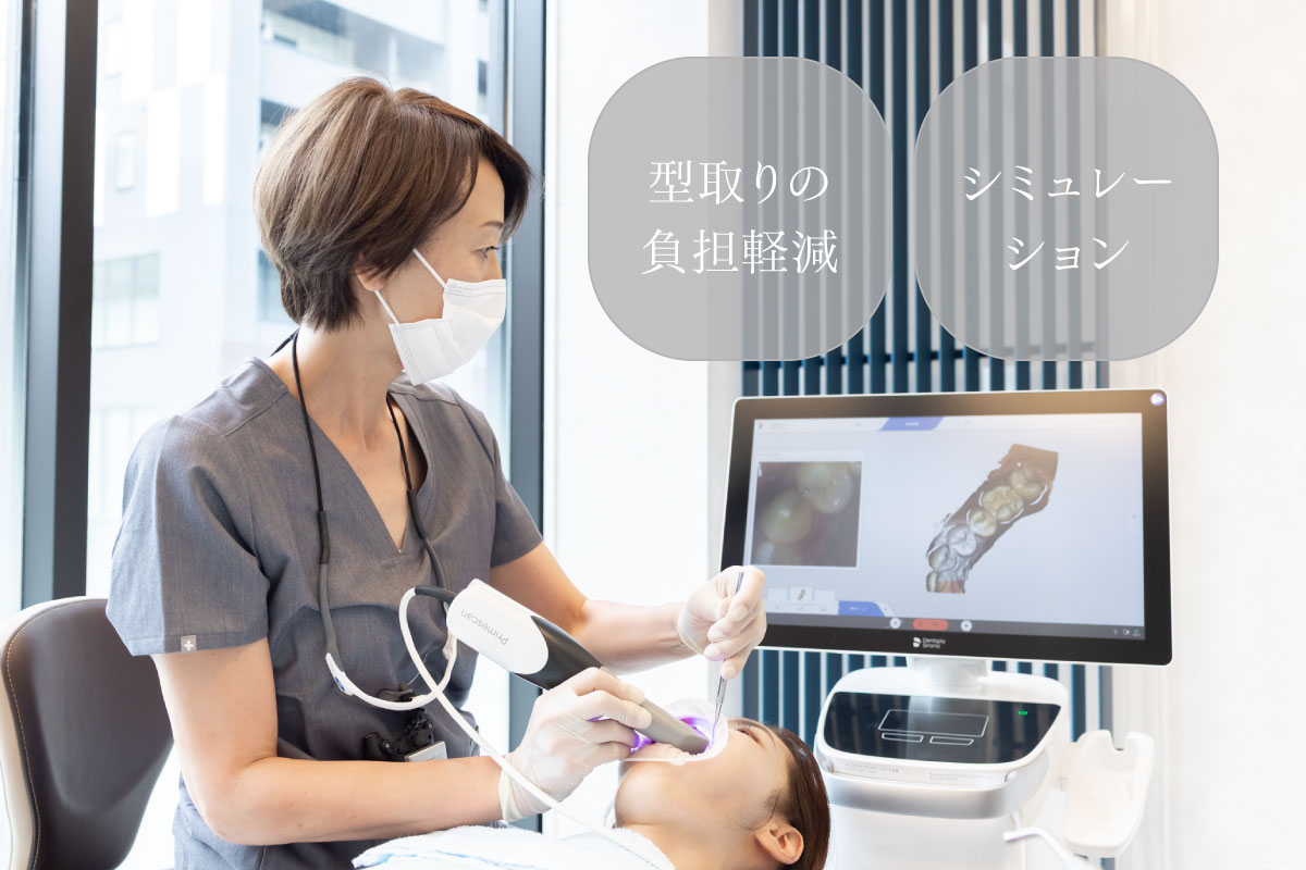 「型取りの負担軽減」「シミュレーション」