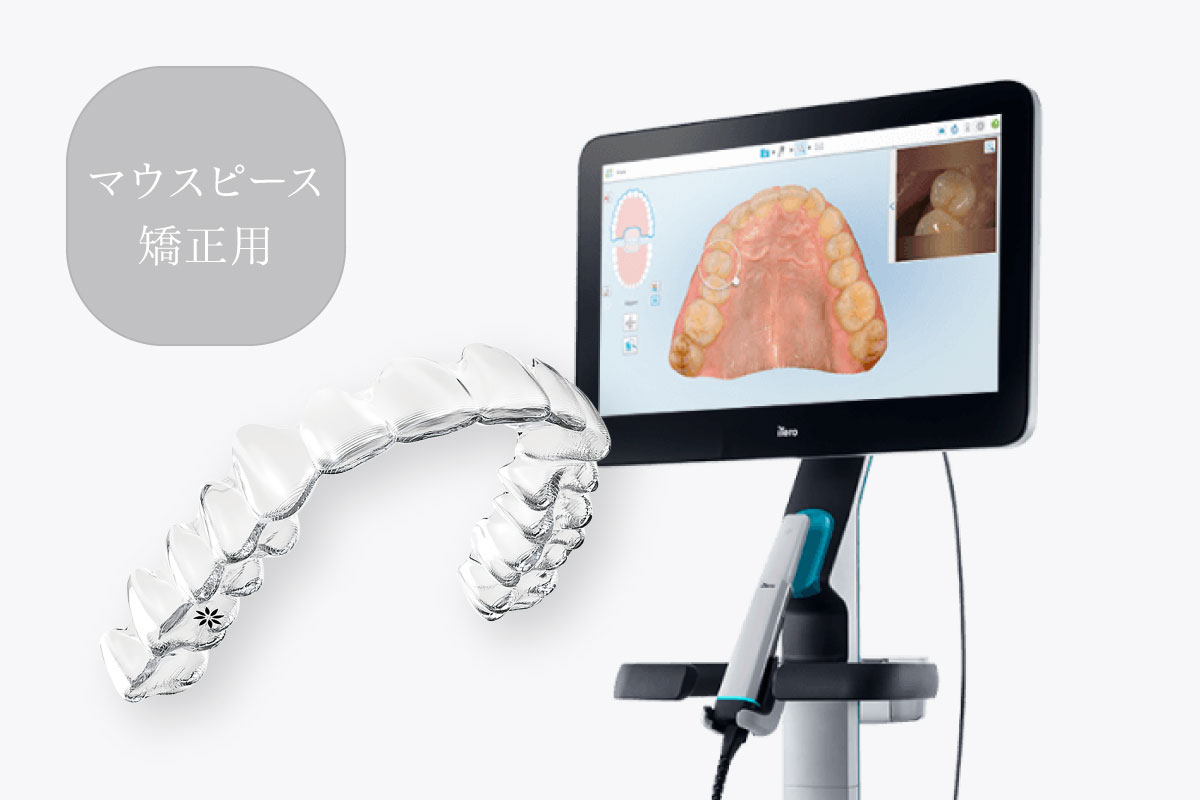 マウスピース矯正用