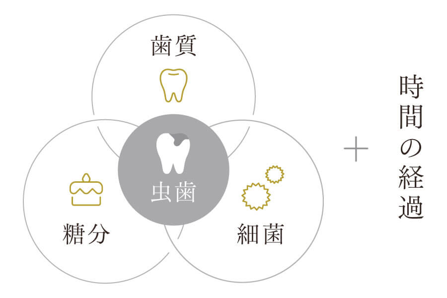 虫歯は「歯質」「糖分」「口腔内の細菌」の3要素に「時間の経過」が加わることで発生