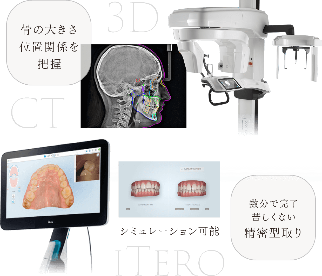 ＜3DCT＞骨の大きさ位置関係を把握　＜iTero＞数分で完了苦しくない精密型取り シミュレーション可能